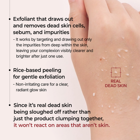 Peel Shot Line