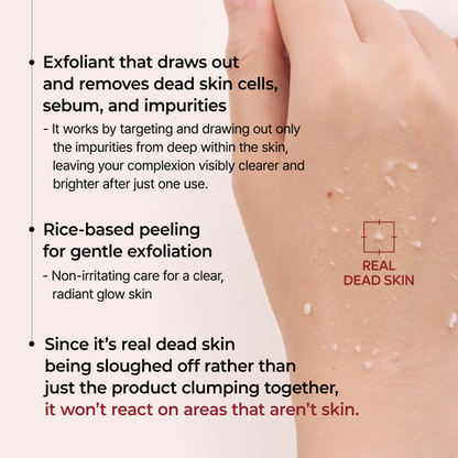 Peel Shot Line